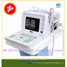 CE Cheapest portable ultrasound machine china portable ultrasound